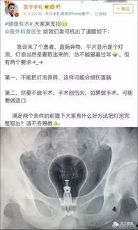 肛门在线观看,一场关于私密话题的探索之旅